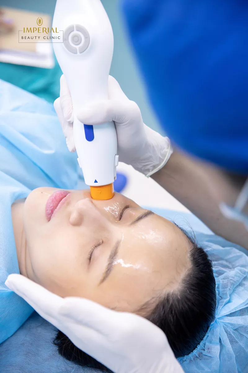 Oligio RF được nhiều khách hàng lựa chọn